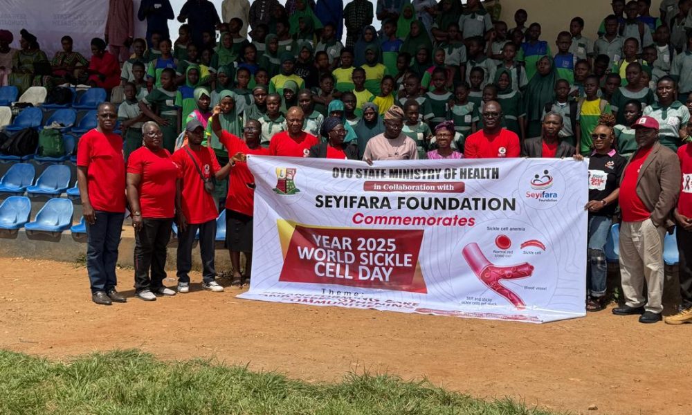 World Sickle Cell Day: Oyo Govt Re-Affirms Commitment To Quality Healthcare Delivery  …as Over 300 participants received free medications